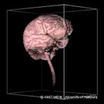 First ever 3D reconstruction of a living brain from MRI