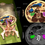 Cross-sectional anatomy of the torso