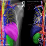 X-ray image with color marked organs