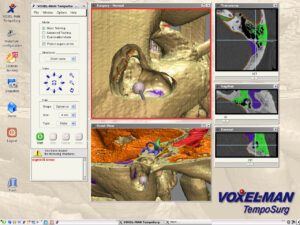 User interface of VOXEL-MAN TempoSurg