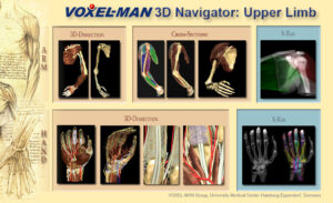 Visual table of contents of the VOXEL-MAN 3D-Navigator: Upper Limb