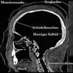 Reconstructed sagittal cross-section