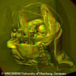 Virtual dissection of the Visible Human's brain in red/green stereo