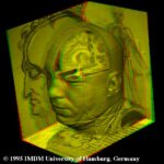 Virtual dissection of the Visible Human's head in red/green stereo