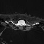 CT-Scan des geflügelten Skarabäus zwischen Leinenbandagen (oben) und Rippen (unten)