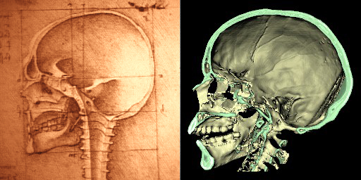 Leonardo's drawing of a sagittal cut through the skull and an analogous 3D rendering from CT data of a 2300 year old mummy (1989)