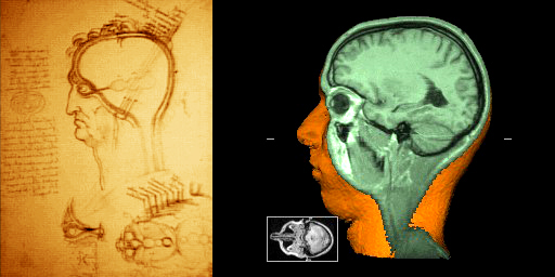 Leonardo's drawing of a sagittal cut through the human head and an analogous 3D rendering from MRI data of a patient (1989)