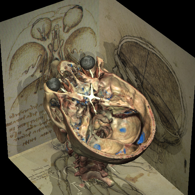 The Visible Human's skull within drawings of Leonardo da Vinci (1998)