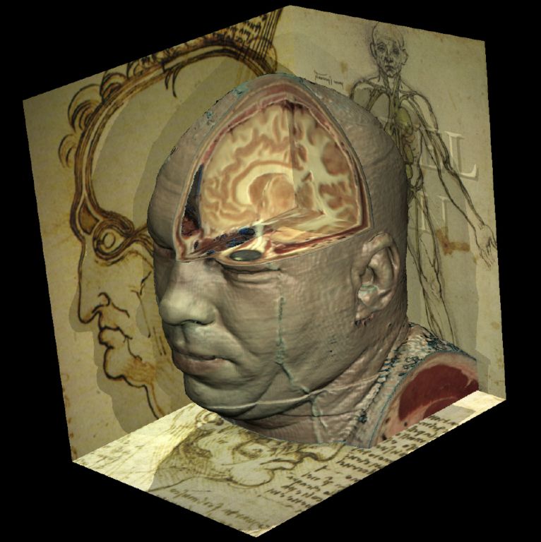 The Visible Human's head within drawings or Leonardo da Vinci (1996). Note the shadow cast from the model onto the drawing.