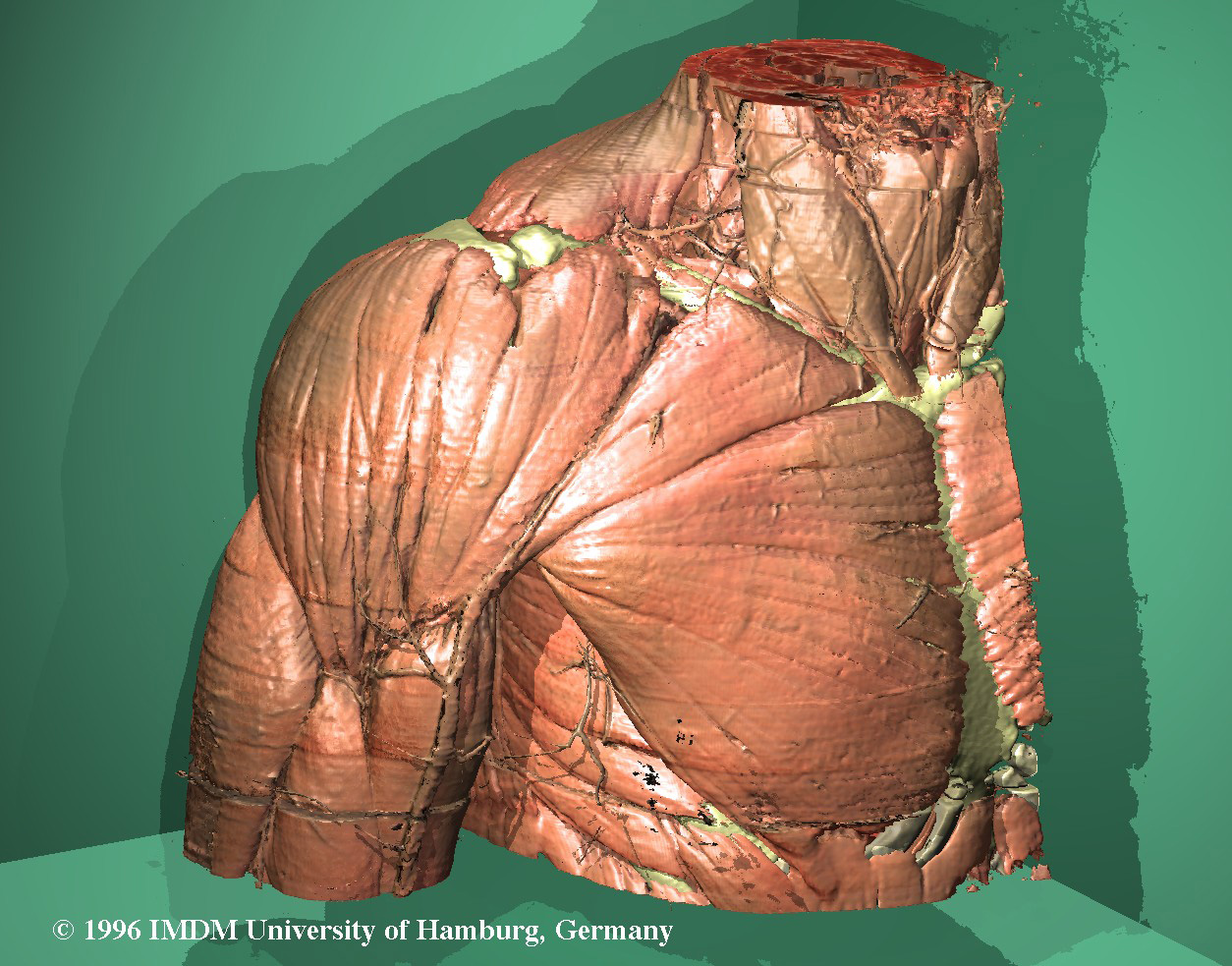 Musculature of the Visible Human's shoulder rendered with the VOXEL-MAN system